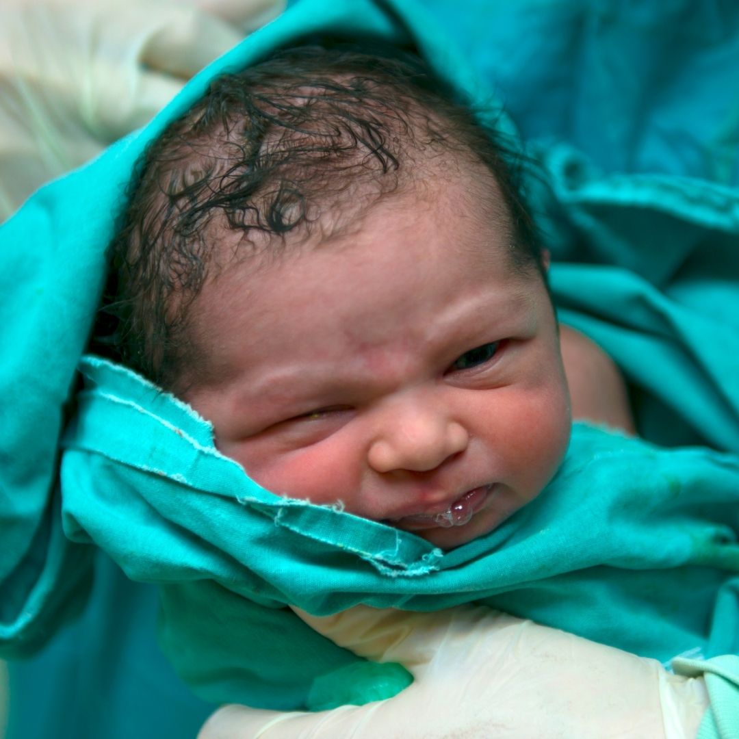 You are currently viewing Recent Placement–Stork Situation