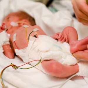 Read more about the article Birth Mother Bonds With Her Baby in the NICU–Is This Wise?