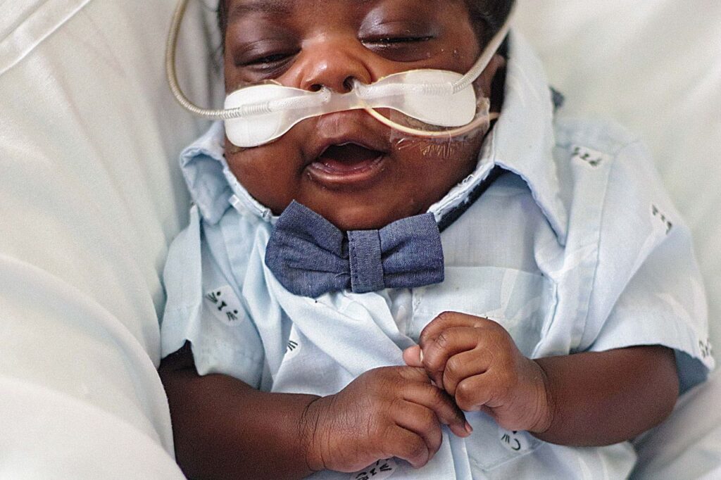 special needs adoption