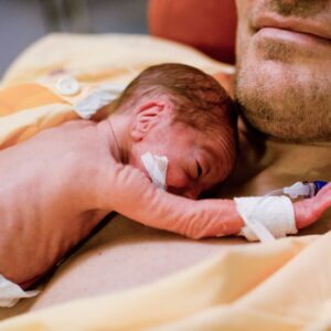 special needs adoption