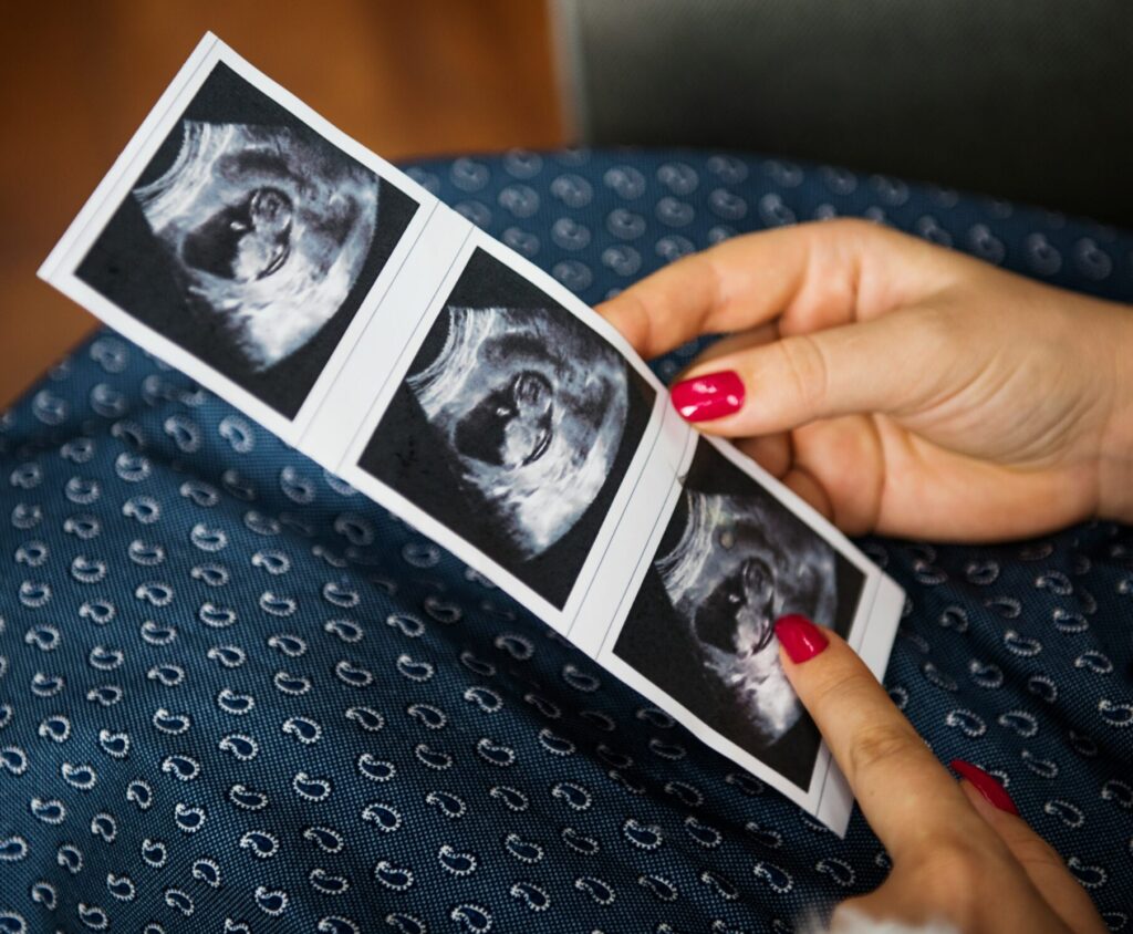 placing my baby for adoption